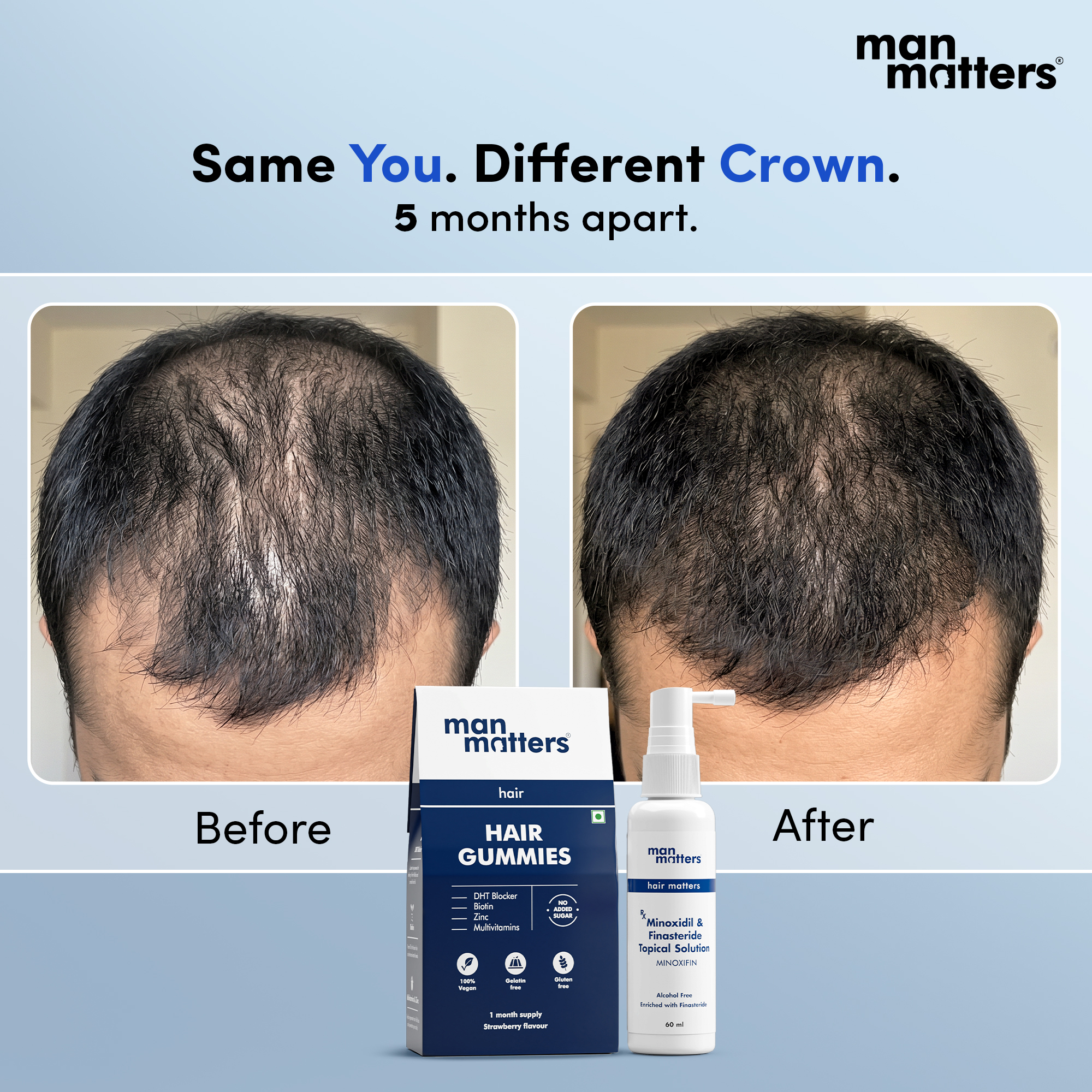 Hair Matters by Man Matters Facebook ad