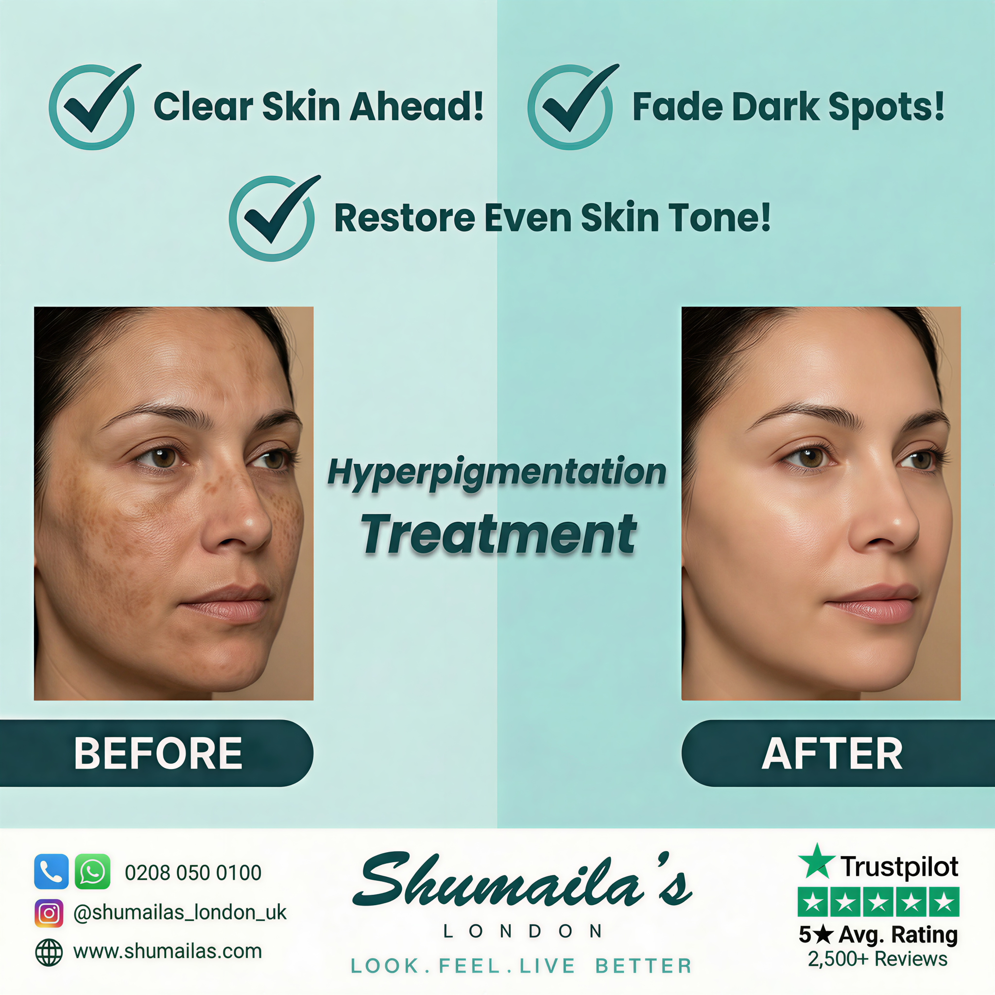 Shumaila's London Aesthetic and Laser Clinics Facebook ad: FREE Consultation!
