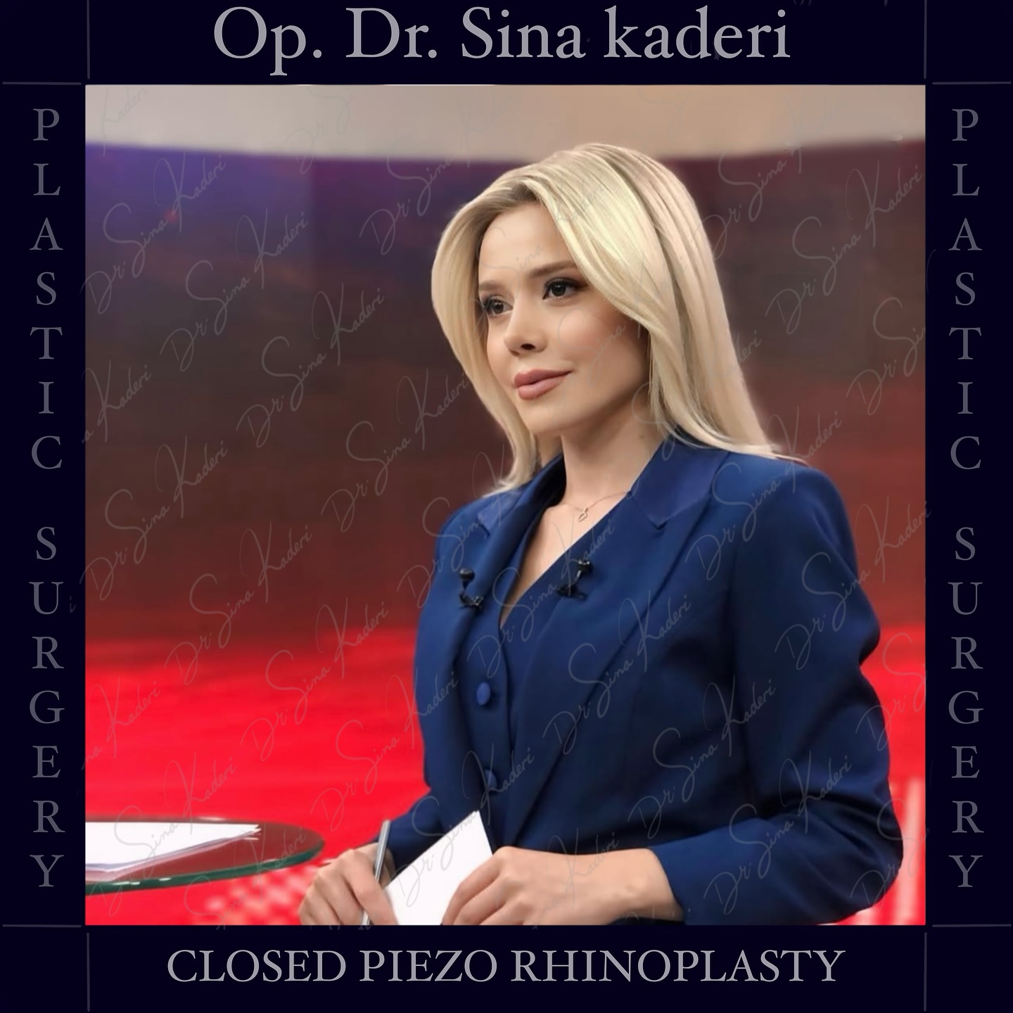 Op. Dr. Sina Kaderi Facebook ad: CLOSED PIEZO RHINOPLASTY