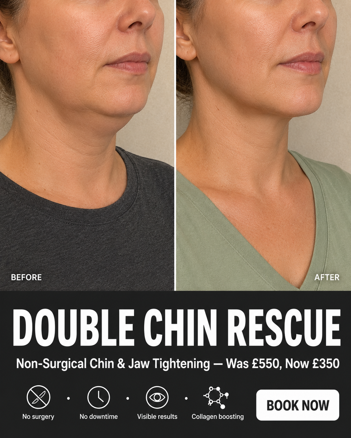 rsakskinandaesthetics Facebook ad: Non Surgical Neck Lift, Now £350 (Was £550)
