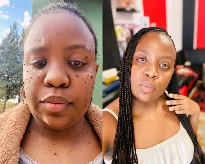 Shape Up and Skin Glow Zm Facebook ad: Tired of Skin Tags & Warts?