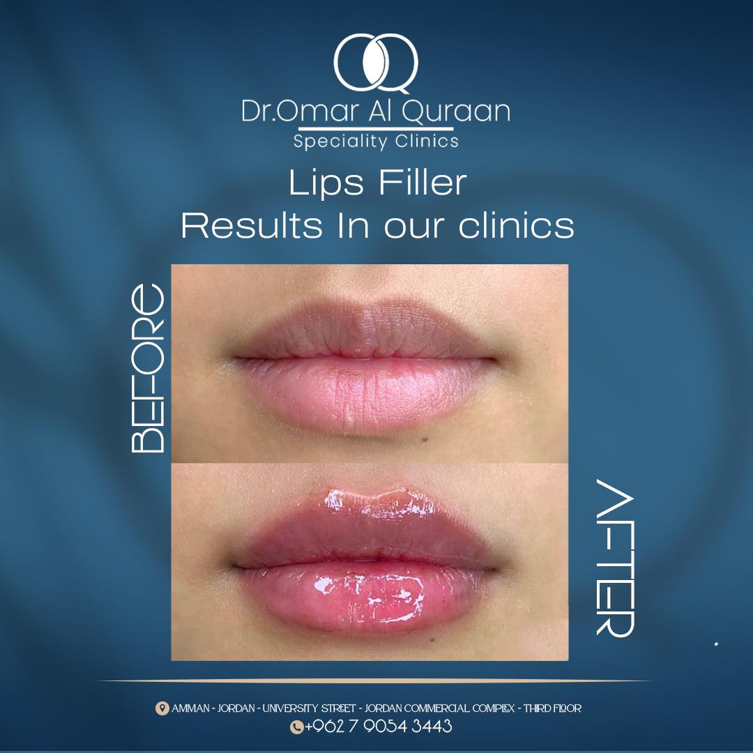 Dr.Omar Al-Quraan Speciality Clinics Group.Jo Facebook ad