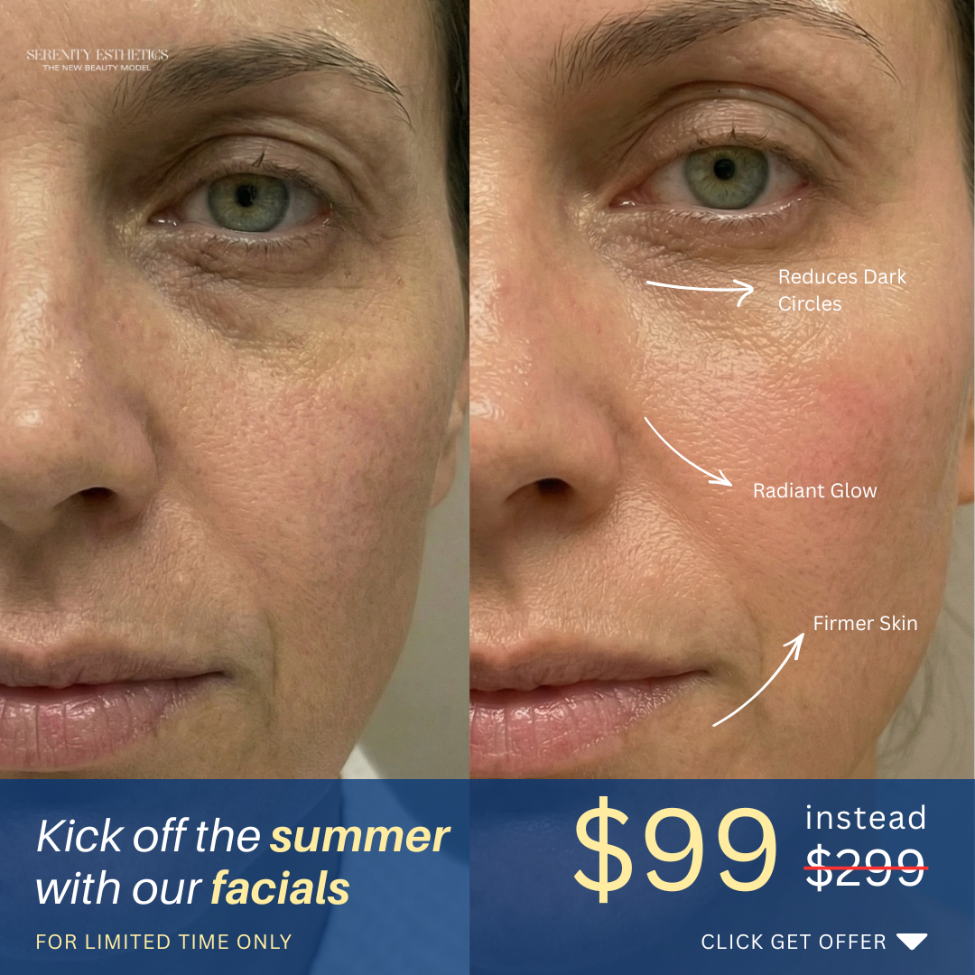 Serenity Spa & Facials Vancouver Facebook ad from Jun 3, 2026
