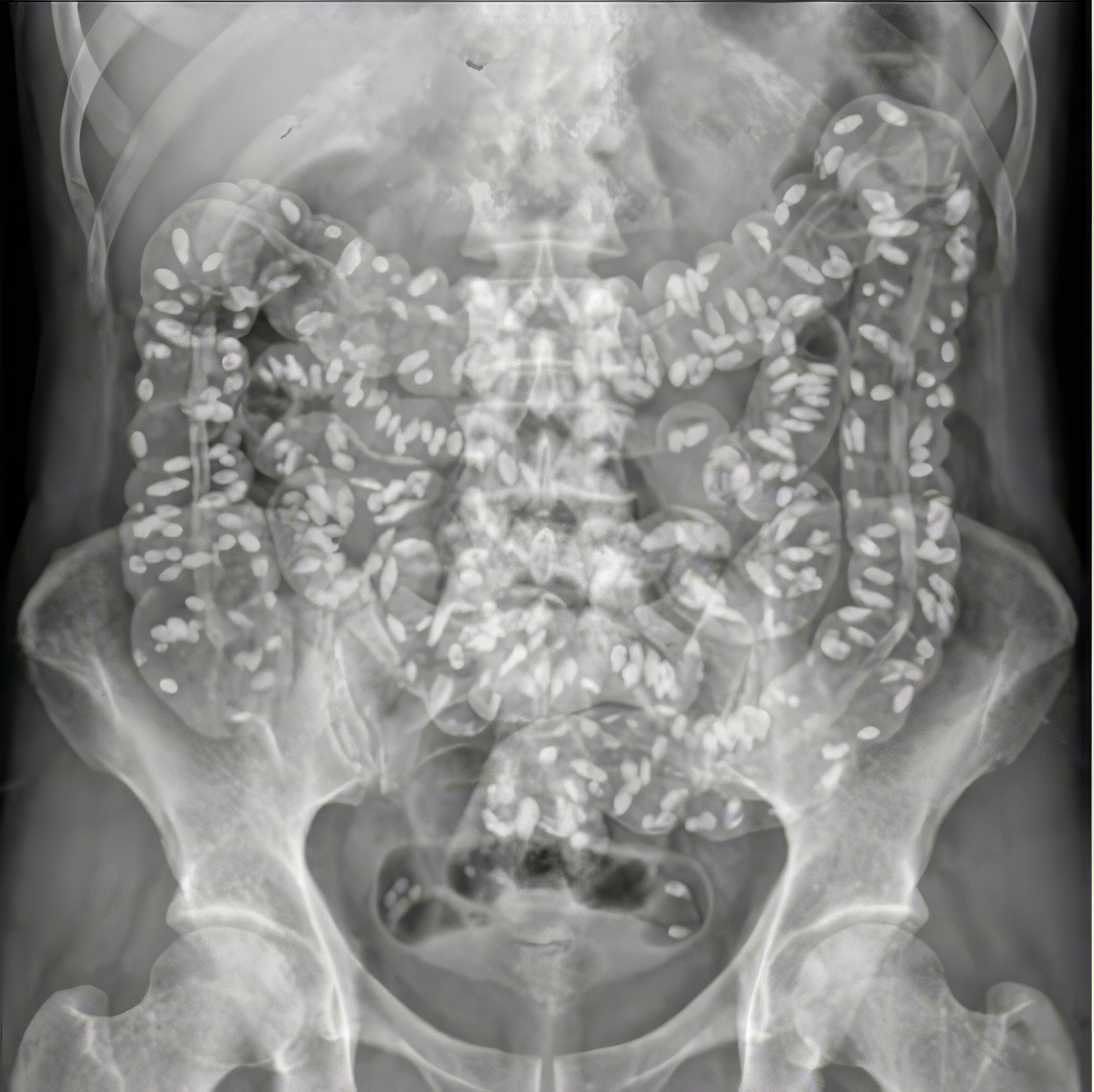Gut Reset Secrets Facebook ad: Read this if cleanses stopped working