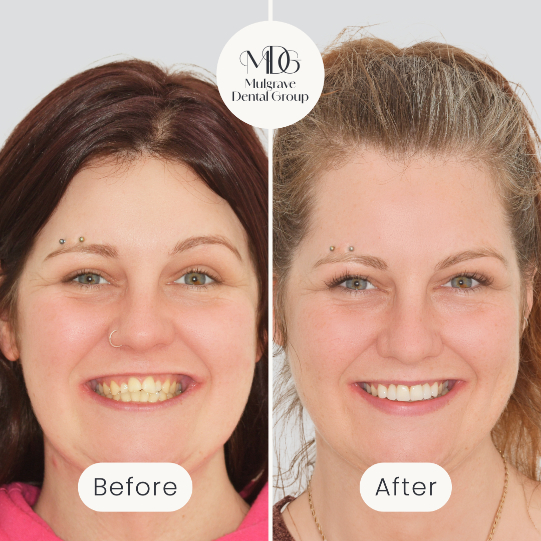 Mulgrave Dental Group Facebook ad