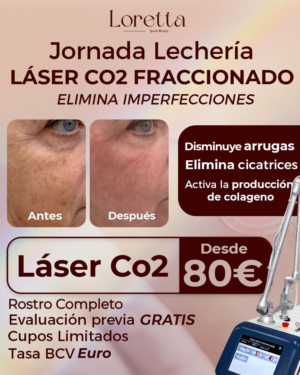 Loretta Spa Facebook ad: Jornada Láser Co2 Lechería