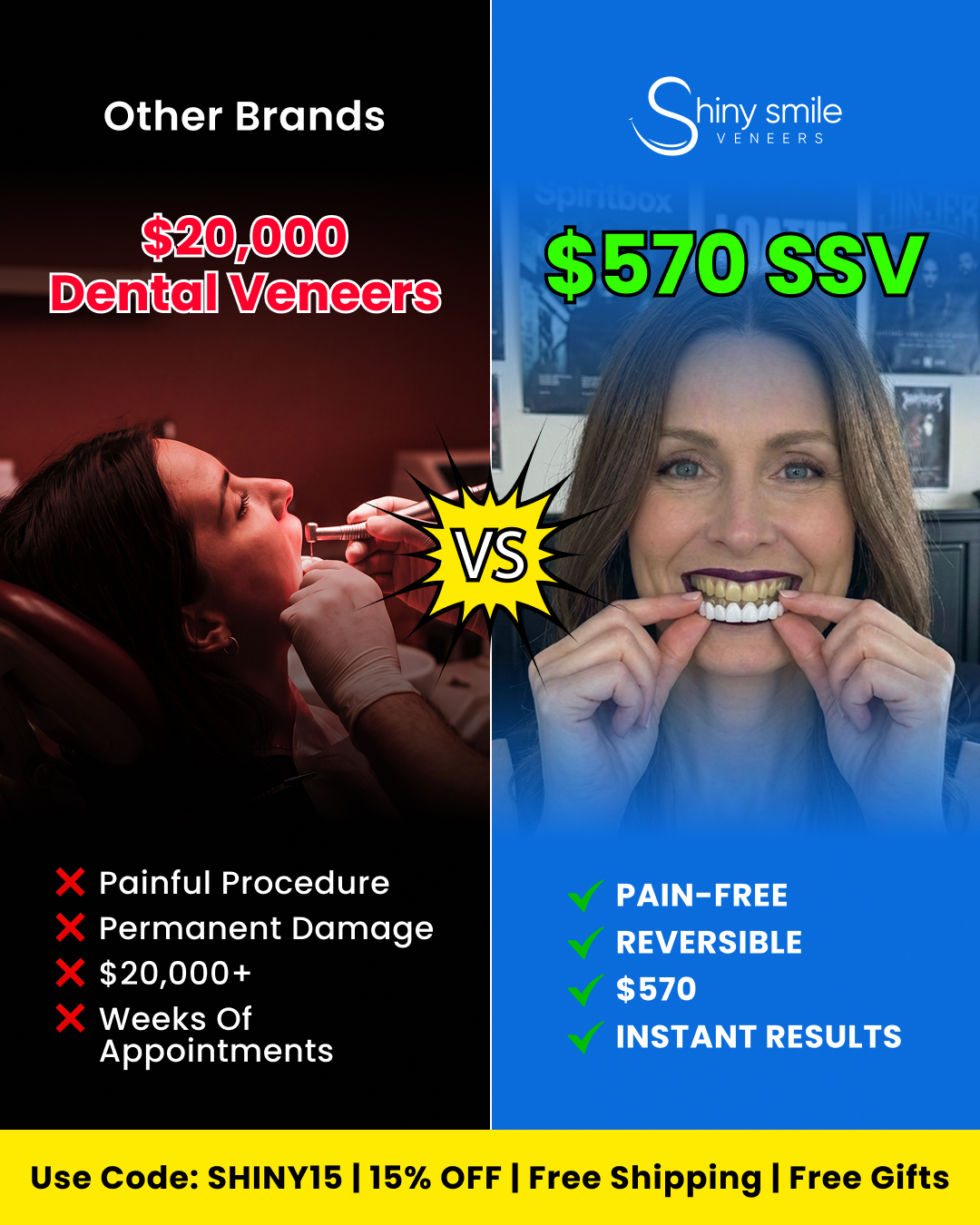 Shiny Smile Veneers Facebook ad from Jun 22, 2026