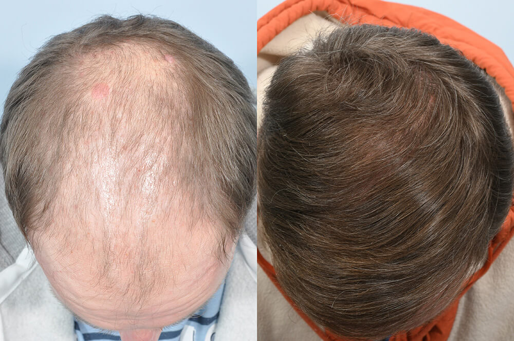 Honest Hair Reviews Facebook ad: Stop Thinning Before It Gets Worse