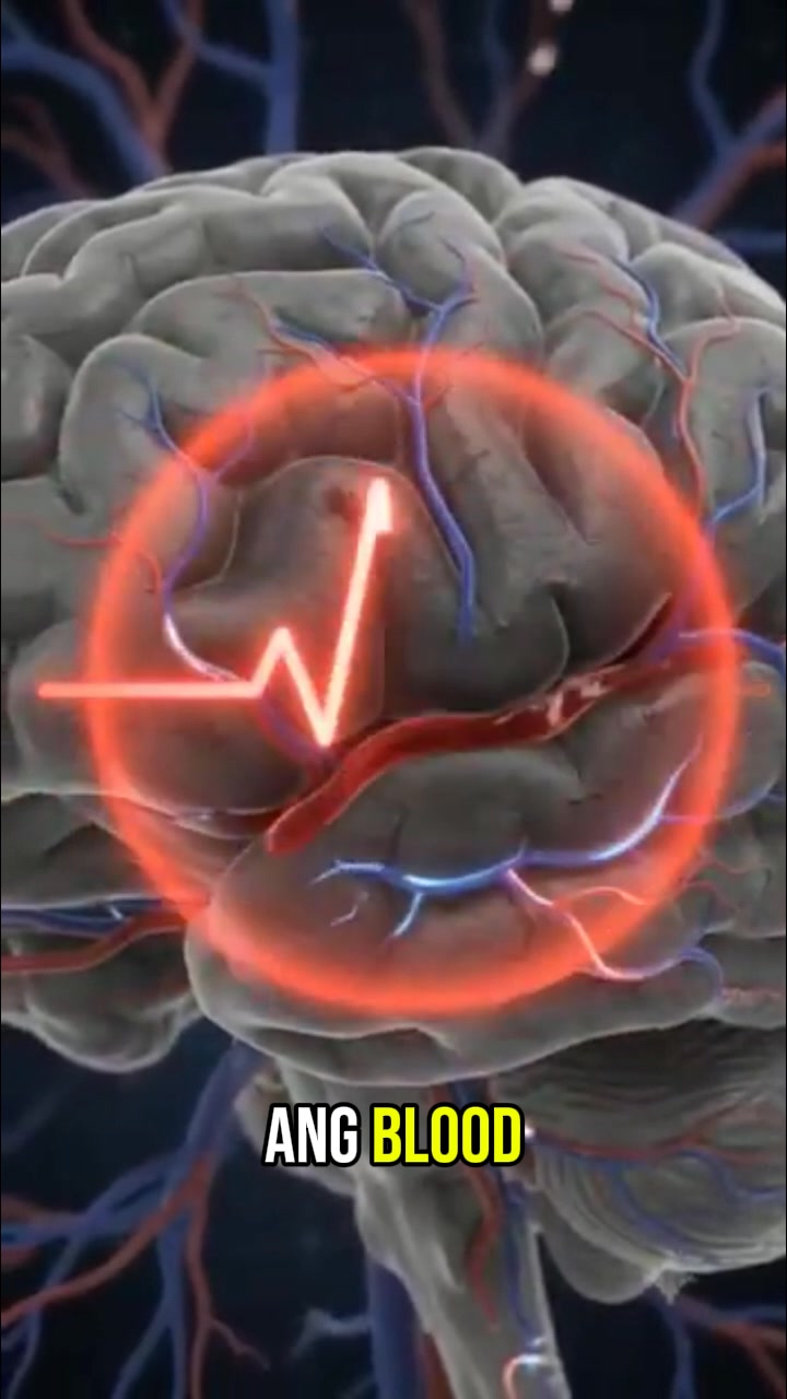 Anti-Stroke Miracle Philippine Giant Clam Oil Facebook ad: Hindi mo na kailangan ng THERAPY