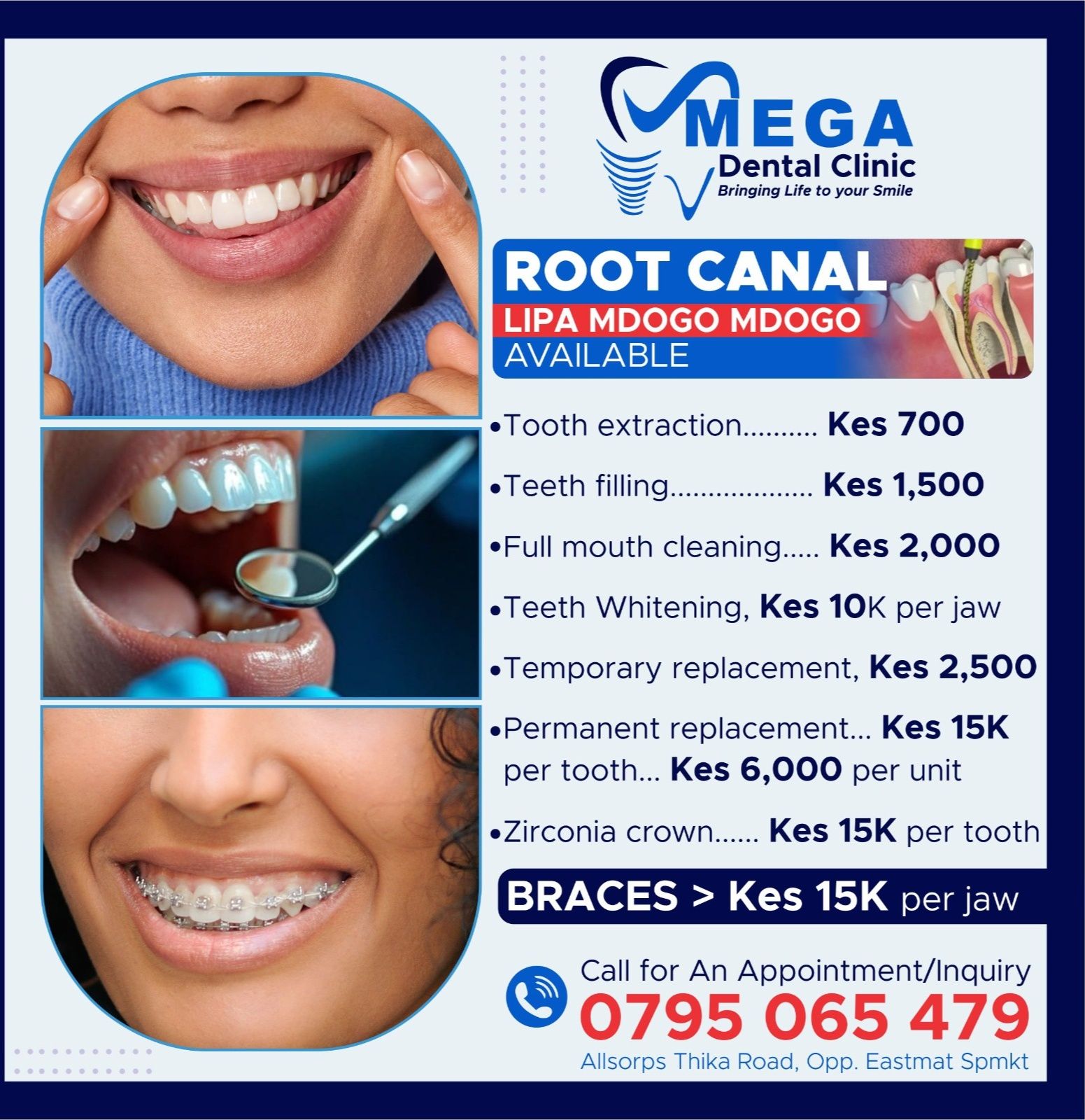 Mega Dental Facebook ad: CALL 0795 065479