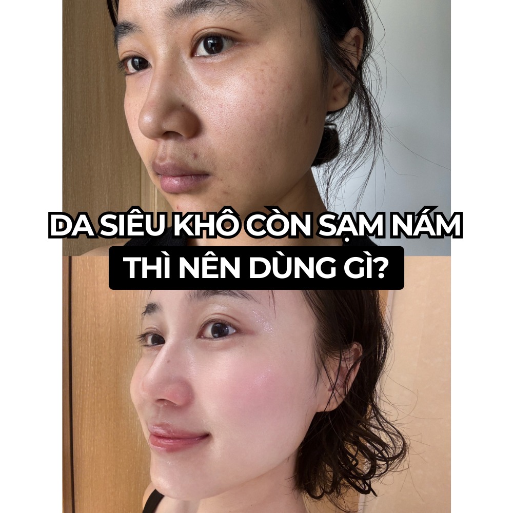 Mei's Story Facebook ad