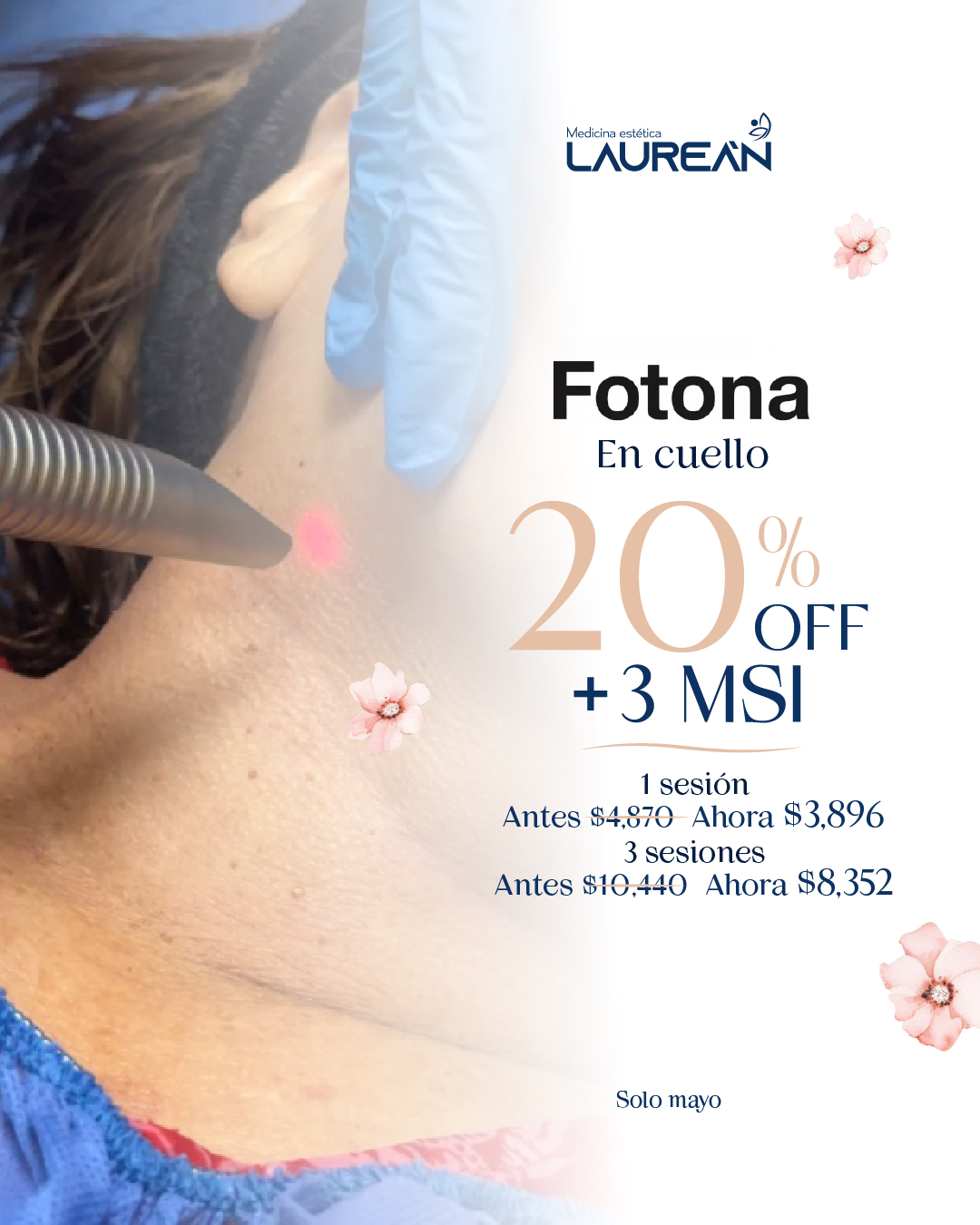 Medicina estética Laurean Facebook ad from May 1, 2026