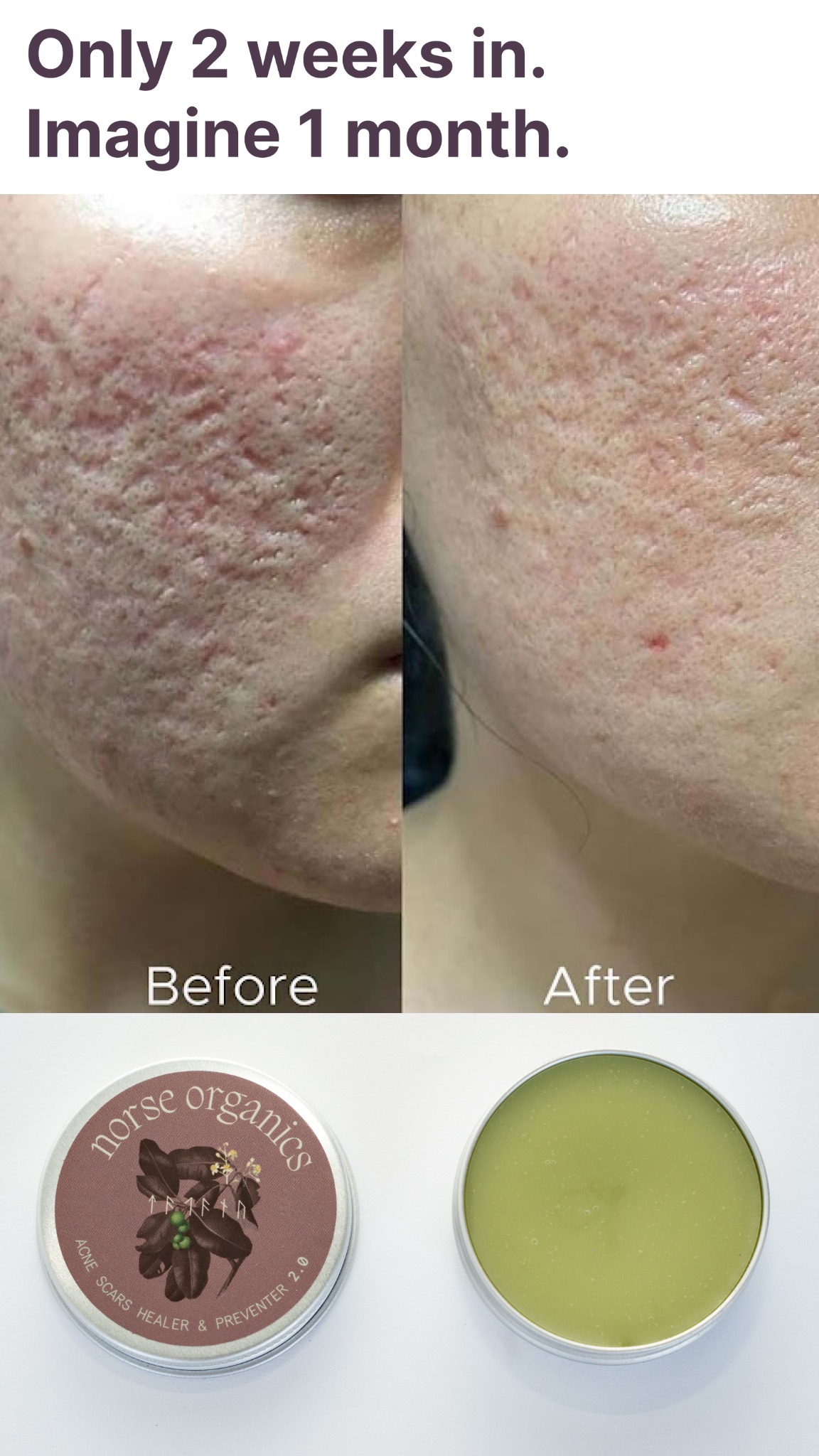 Norse Organics Facebook ad