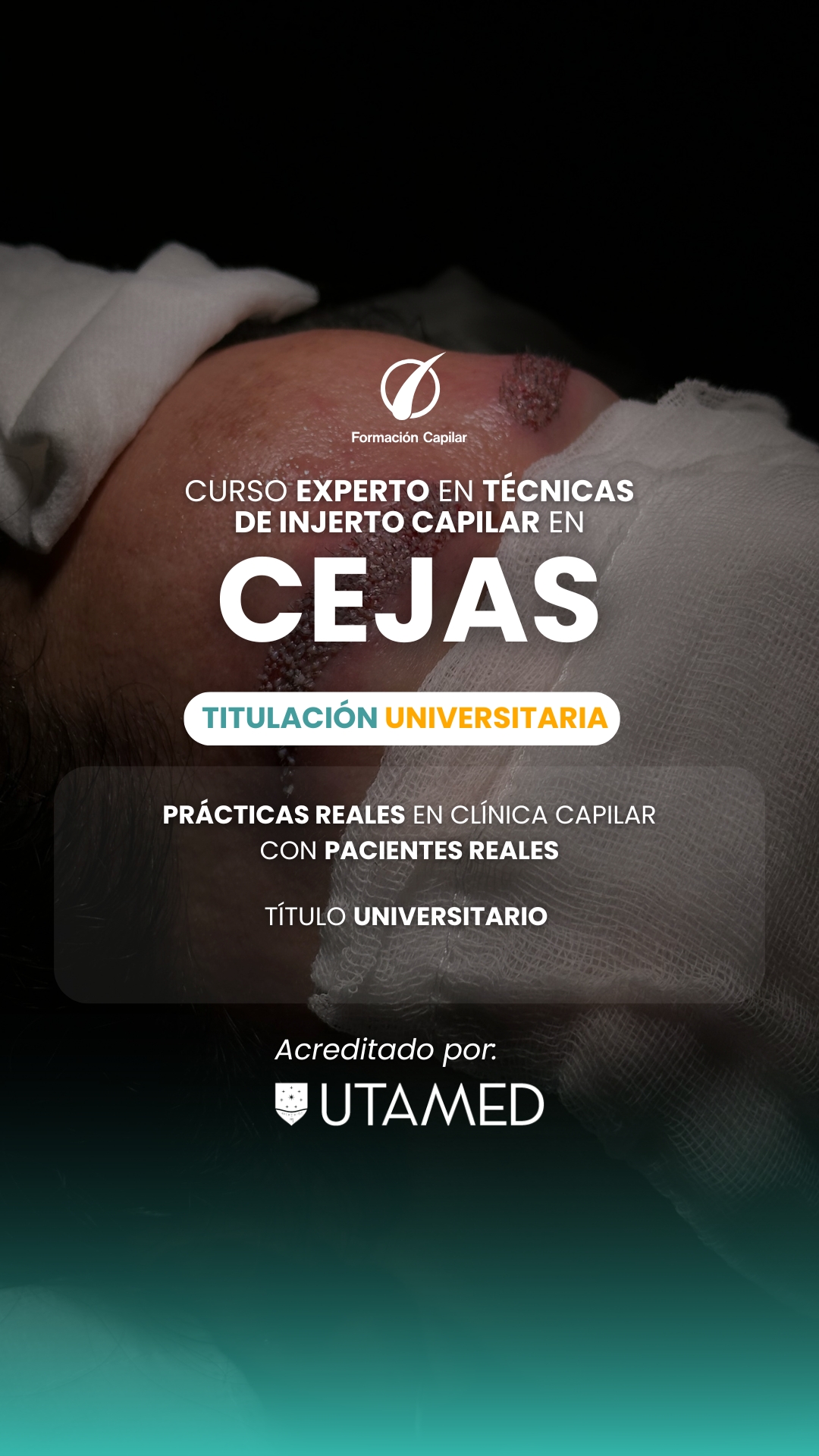 Formación Capilar Facebook ad