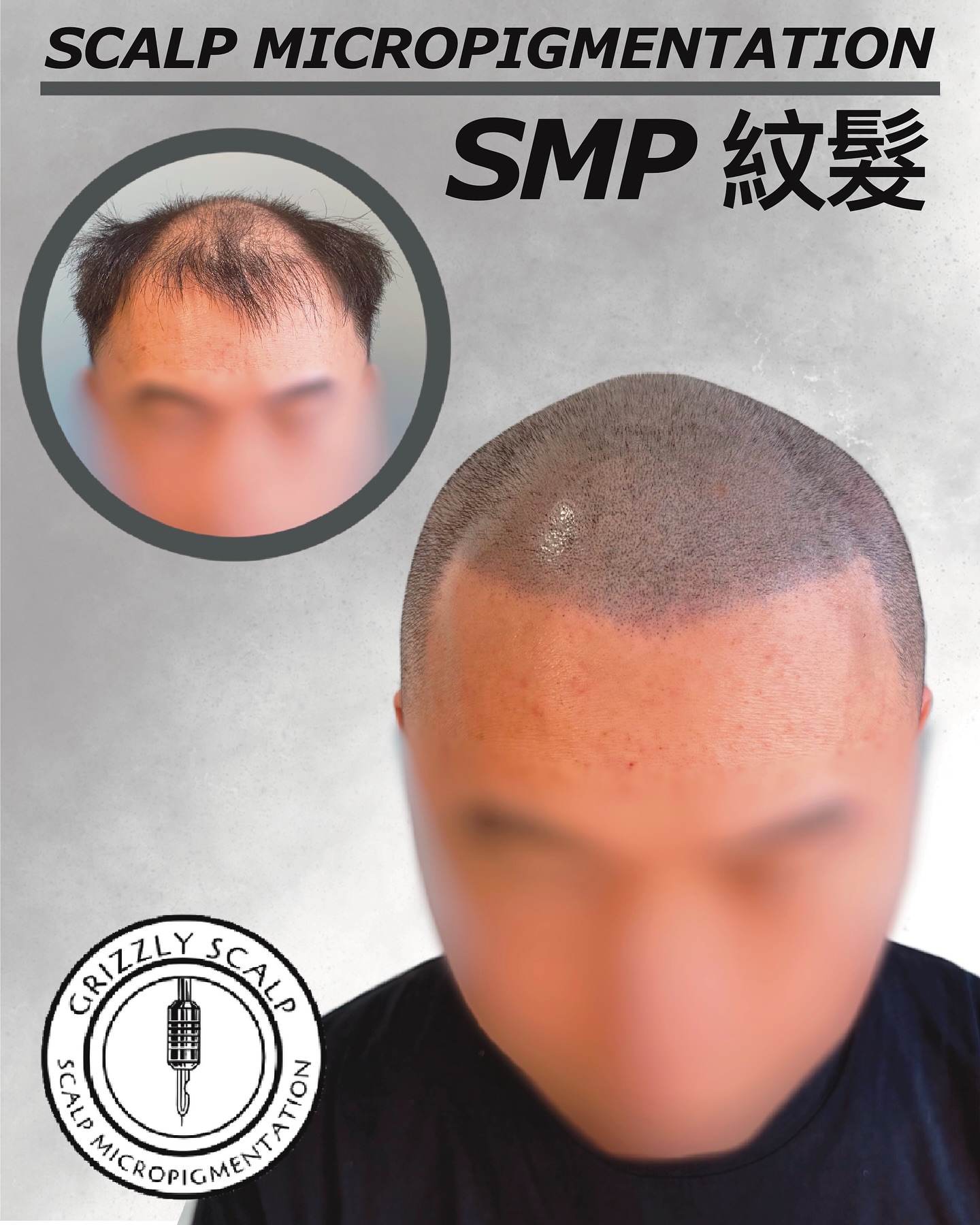 Grizzly Scalp 紋髮 Bob Ng Facebook ad
