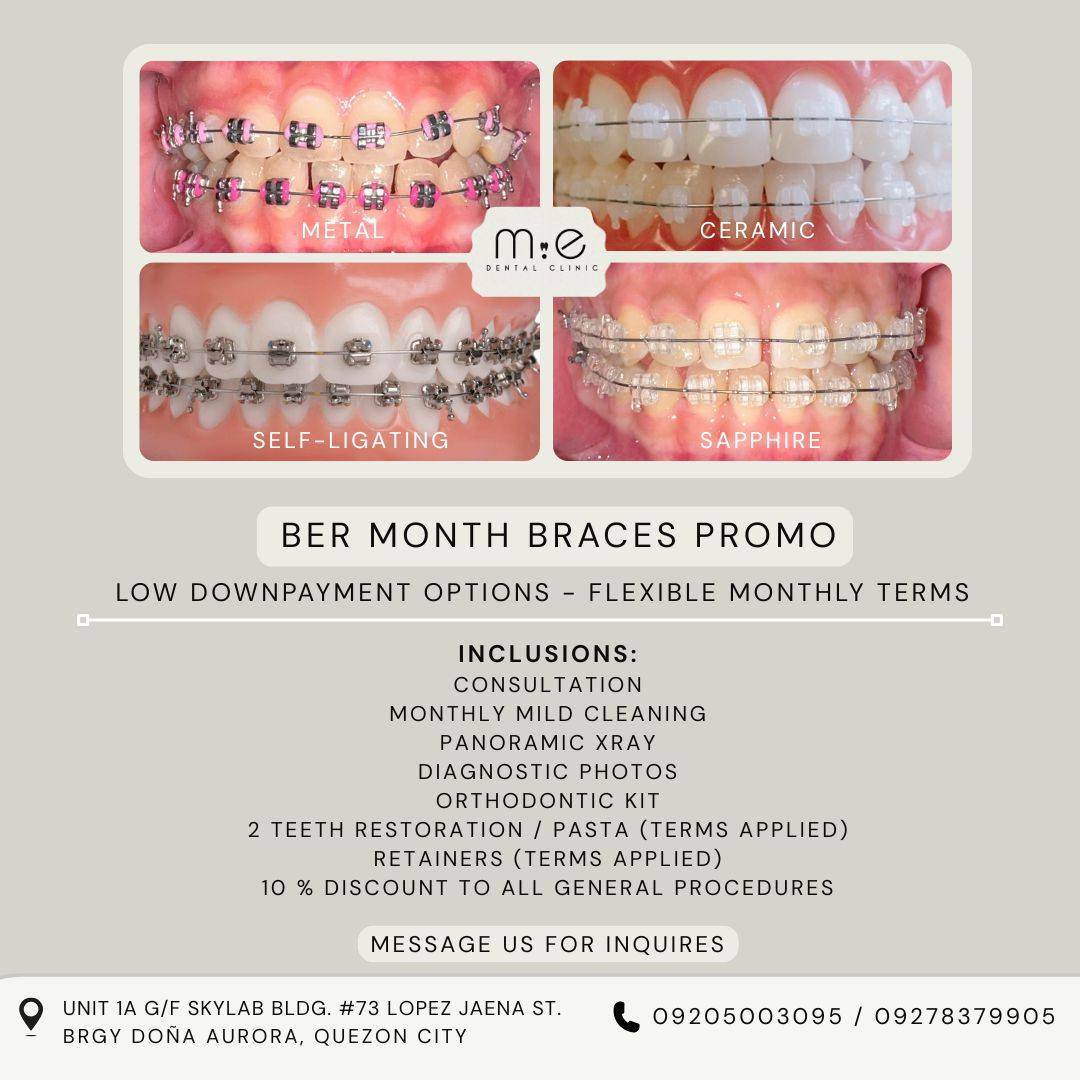 M.E Dental Clinic Facebook ad: The BER months are here… and so is…