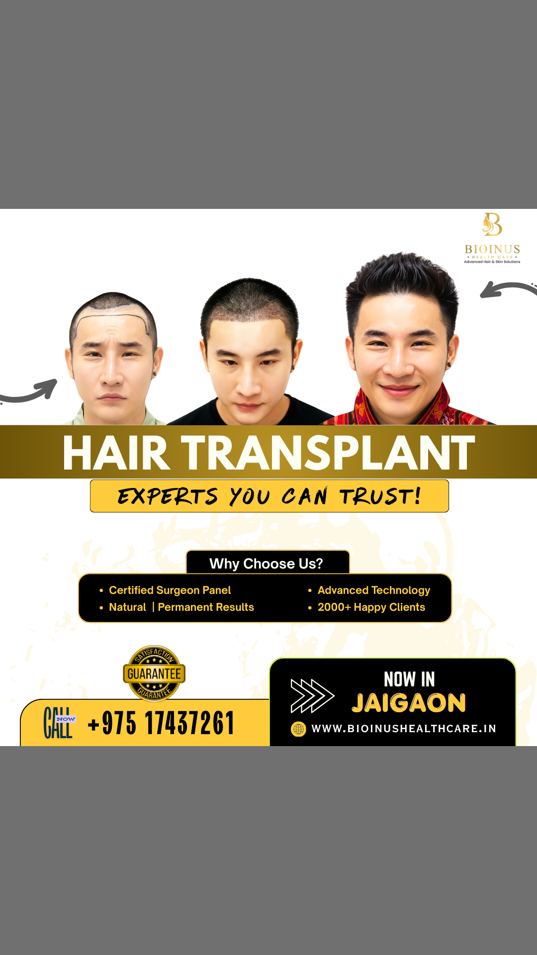 Bioinus Healthcare Advanced Hair & Skin Solutions, Jaigaon Facebook ad