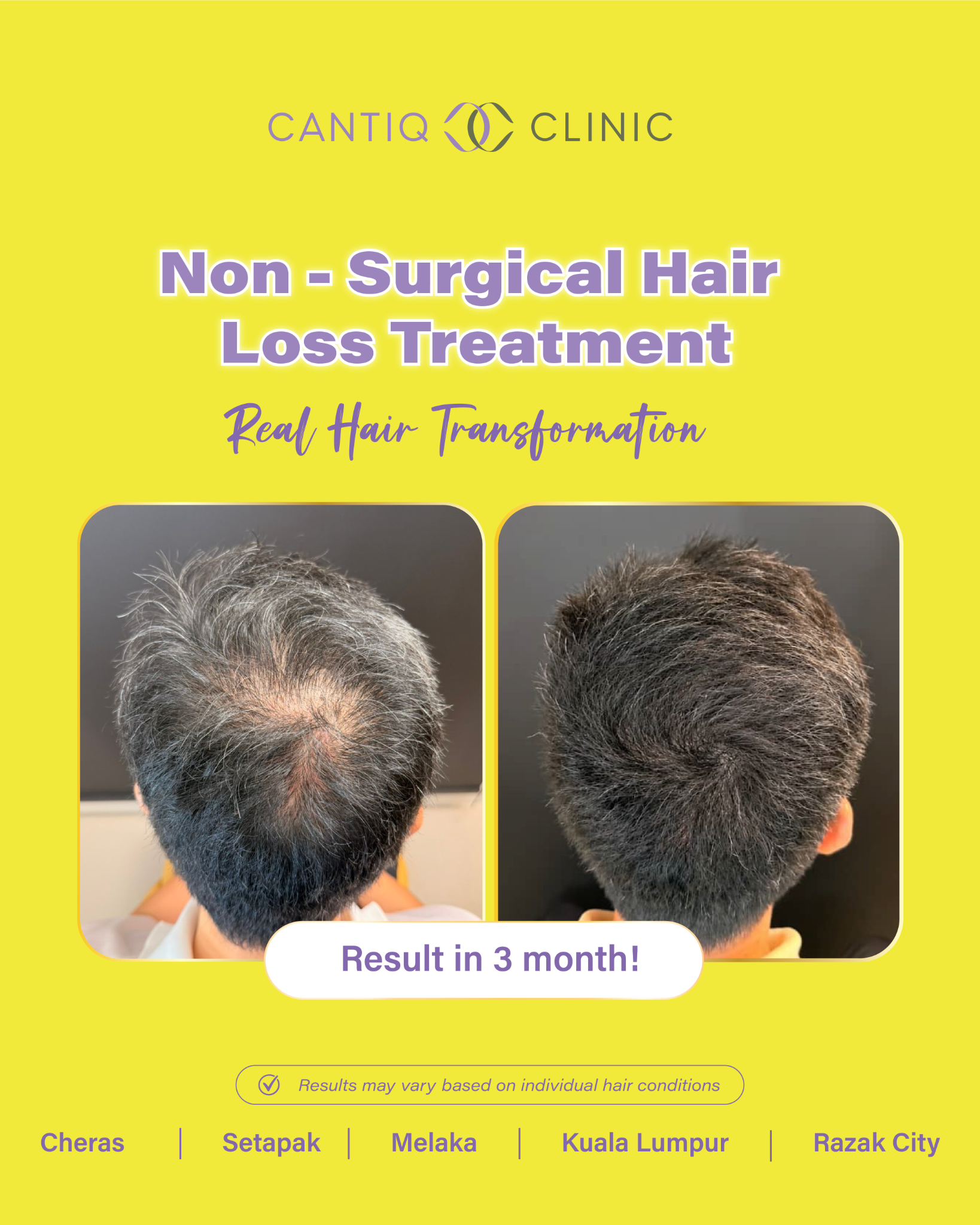Cantiq Clinic Facebook ad: Enter your thicker hair era.
