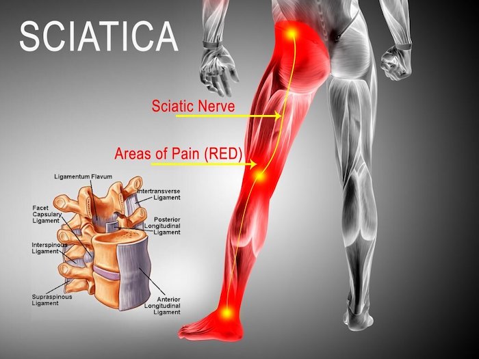 Adjusted Chiropractic Studios Facebook ad