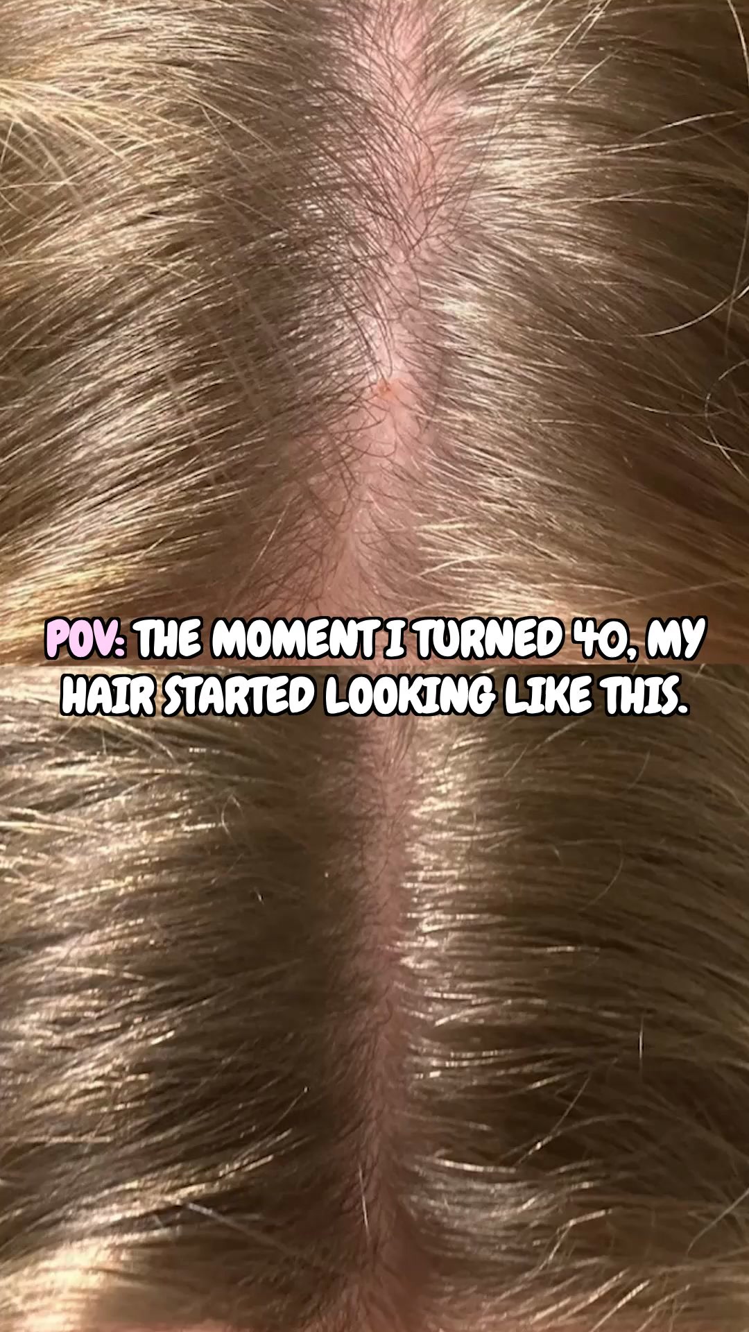 Scandinavian Biolabs Facebook ad: 93% Saw Less Hair Loss in 150 Days