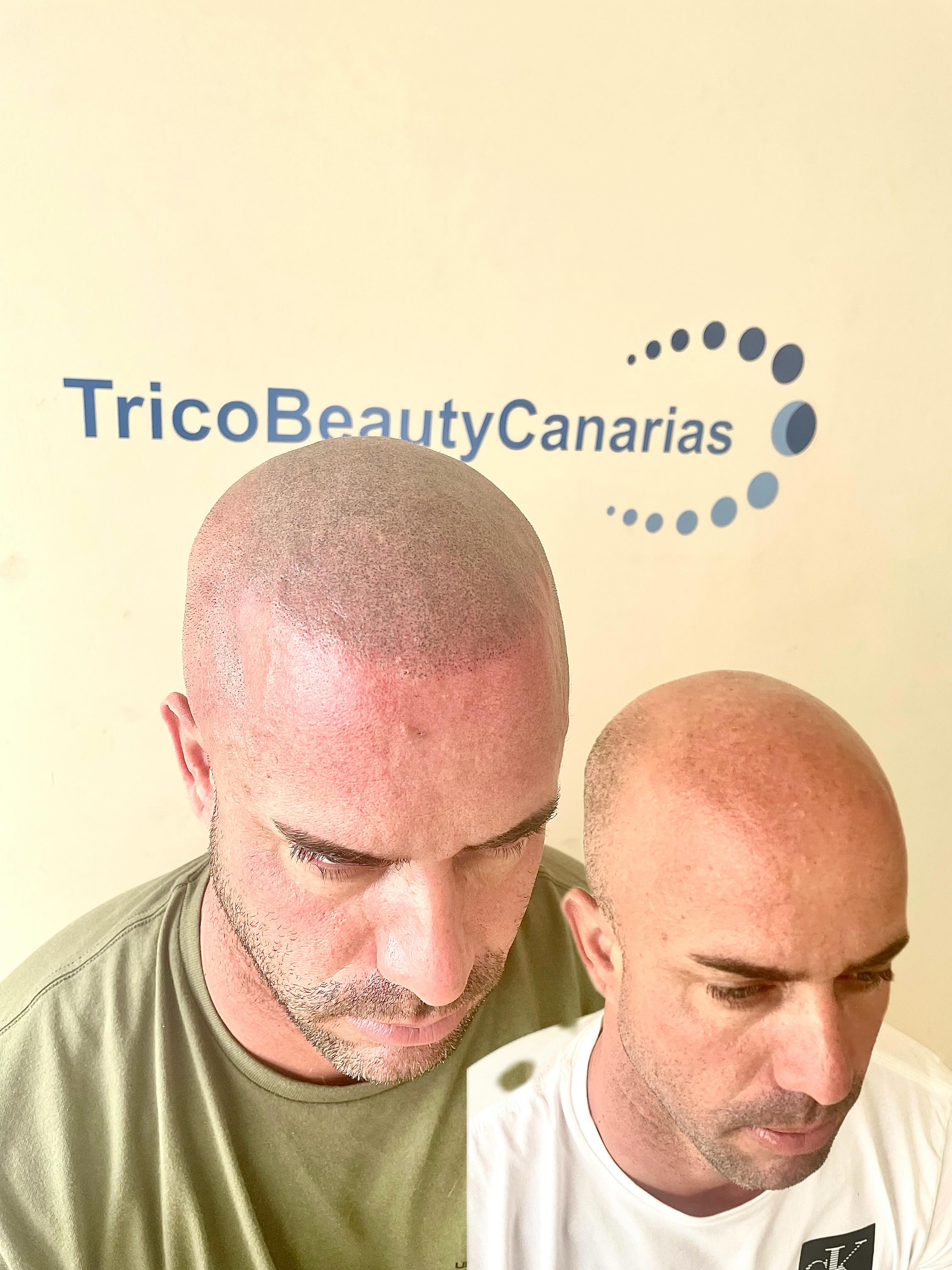 Michele Partipilo Trico Beauty Canarias Facebook ad: Todavía da terminar