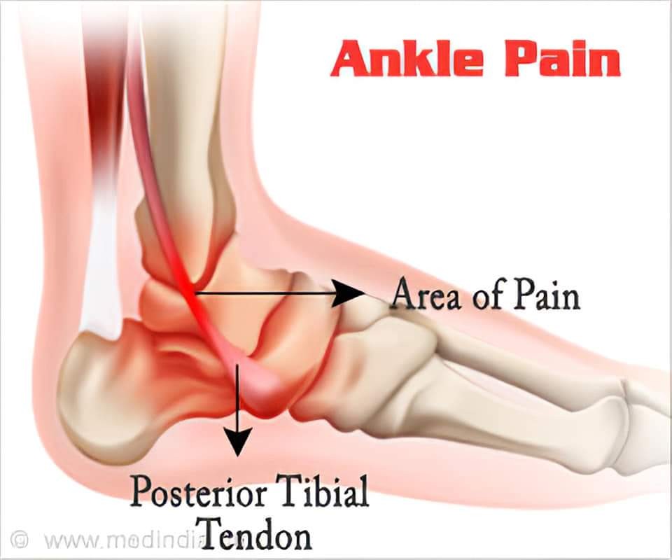 Gaborone Physiotherapy Clinic Facebook ad