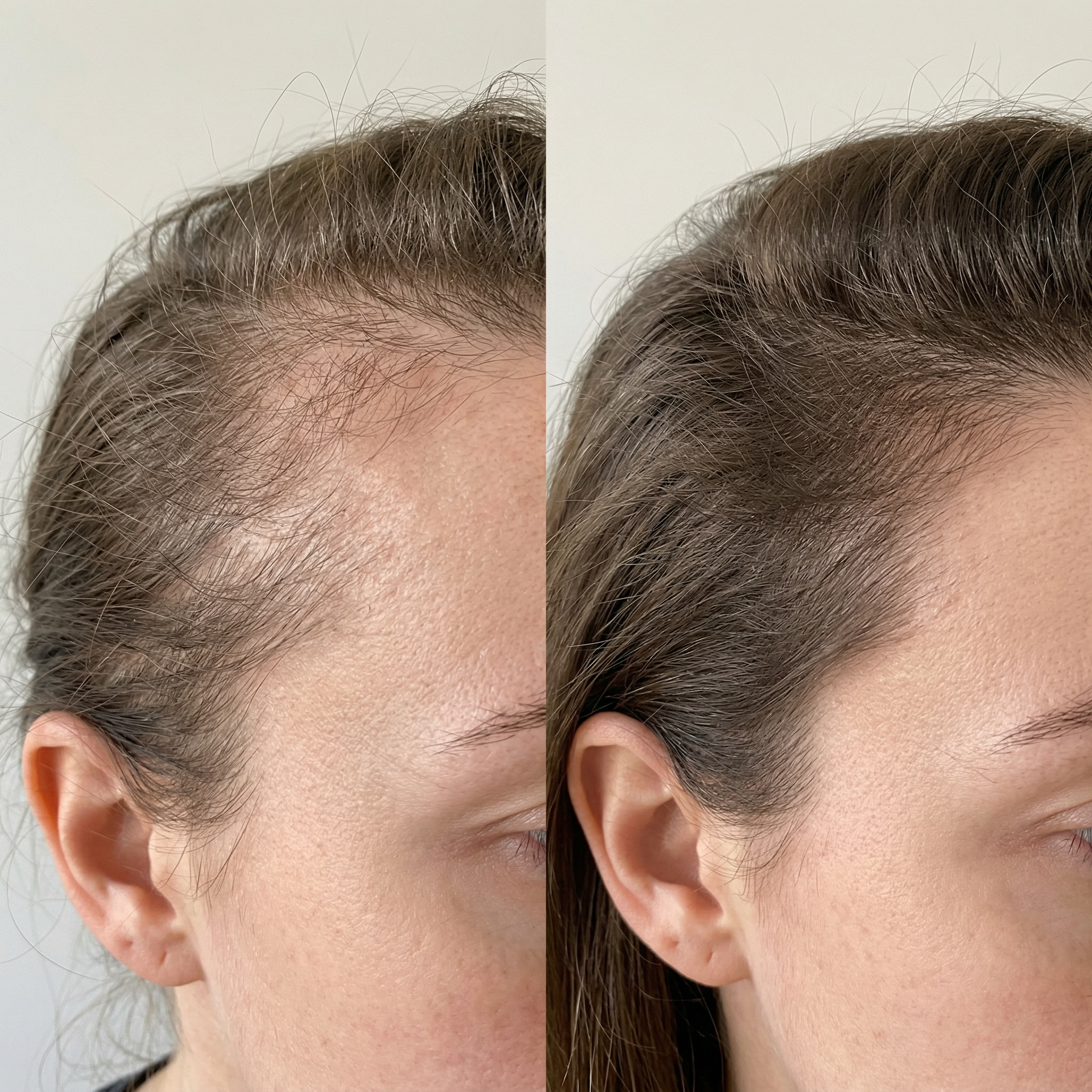 MAYBE PARIS - Soins Capillaires Naturels Facebook ad: Tes cheveux repoussent à 100%.