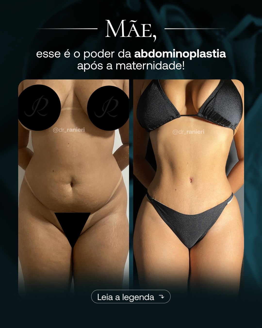Ivan Raniéri Facebook ad: Essa cirurgia não é apenas estética… para muitas…