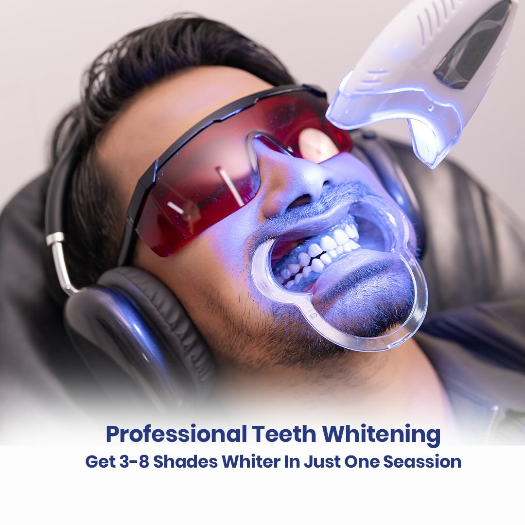 Neo Smile Facebook ad: Looking for professional teeth whitening in Dhaka?