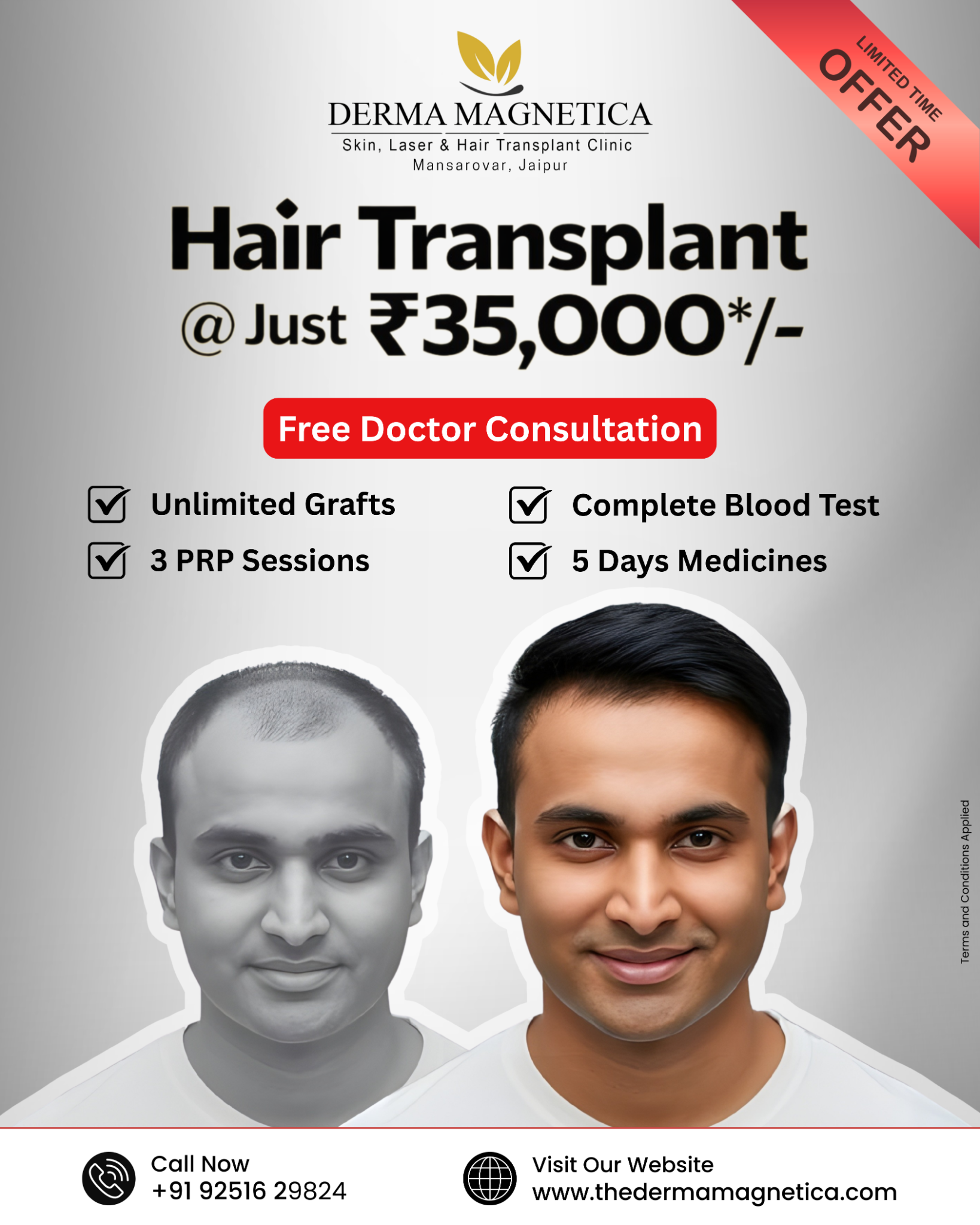 Derma Magnetica Clinic Facebook ad: Hair Transplant at Just Rs. 35,000