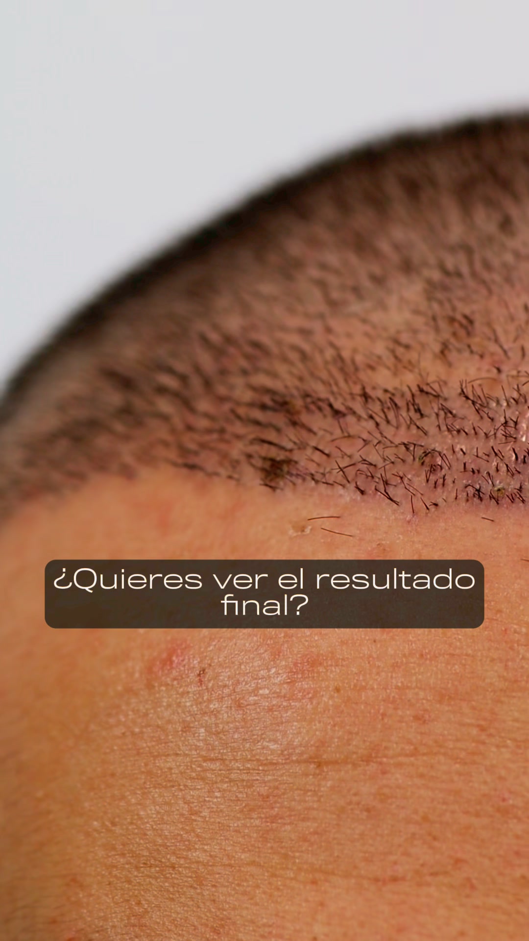 Dr Edgar Pulido - Medicina Estetica Facebook ad: Agenda tu cita GRATIS
