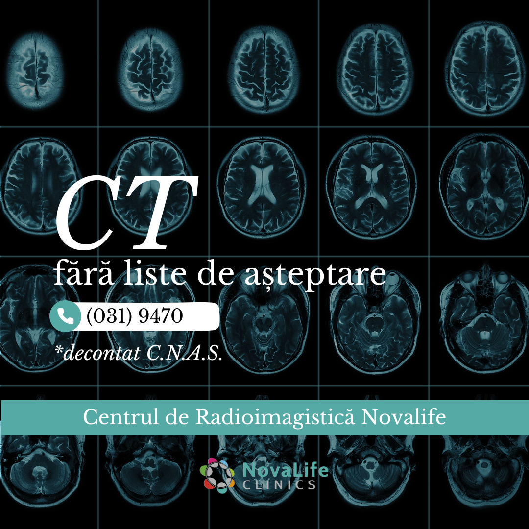 NovaLife Clinics Bucuresti Facebook ad