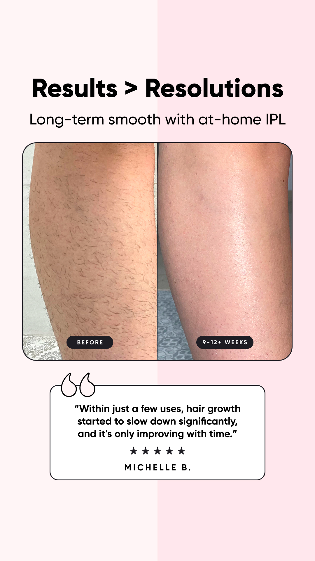 Rose Skin Co Facebook ad