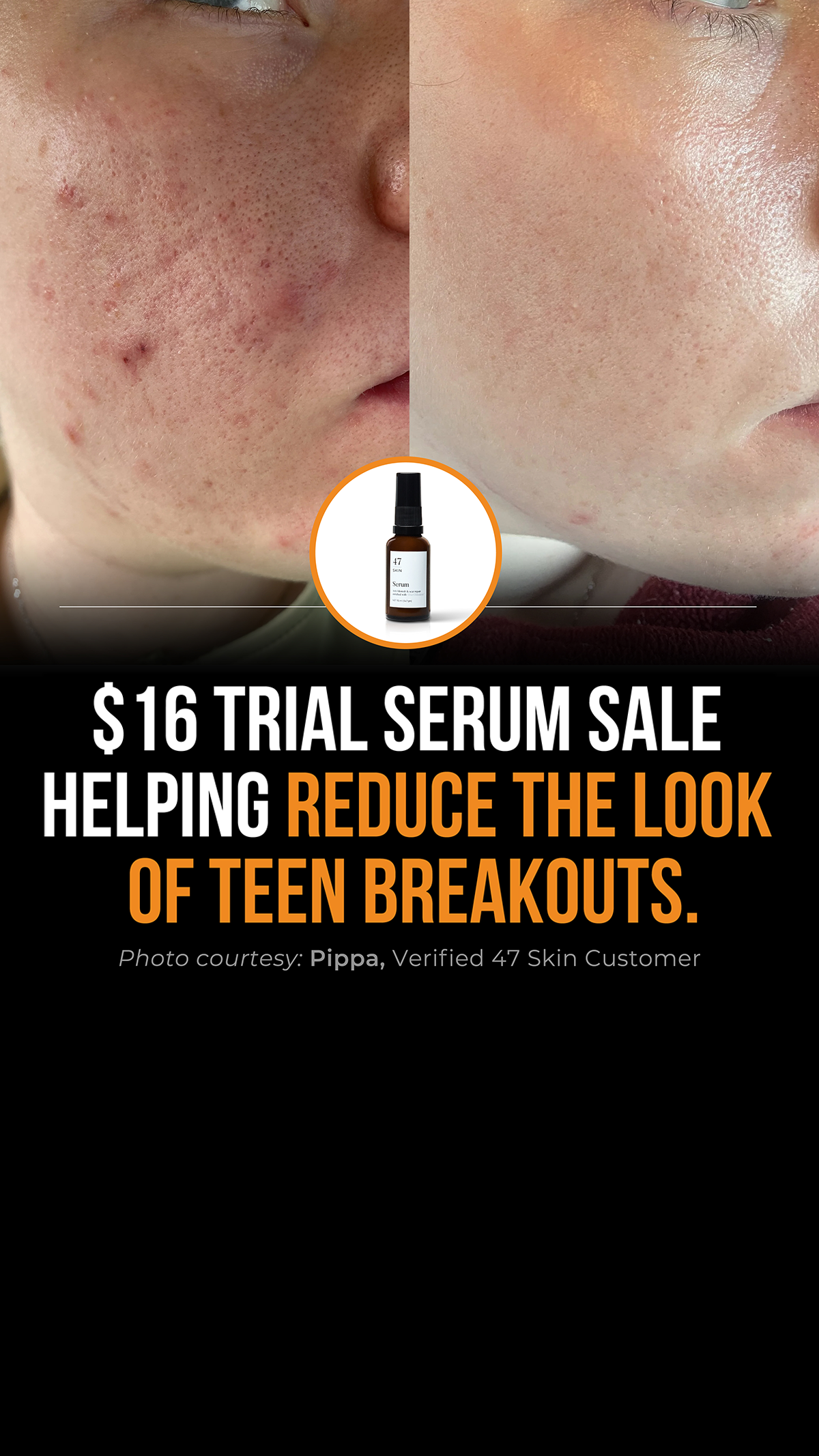 47Skin Facebook ad