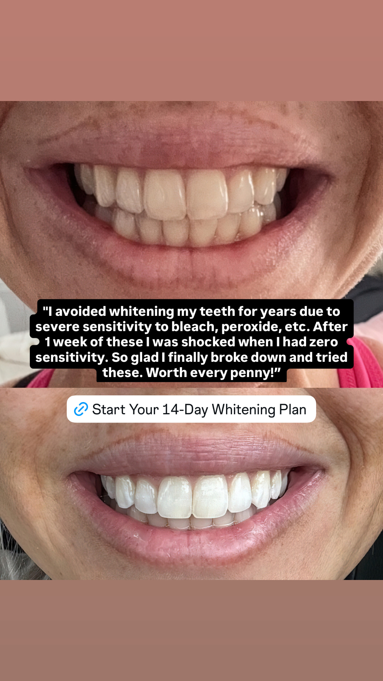 Avery Sweatt Facebook ad: Whiten Your Teeth SAFELY in 2 Weeks