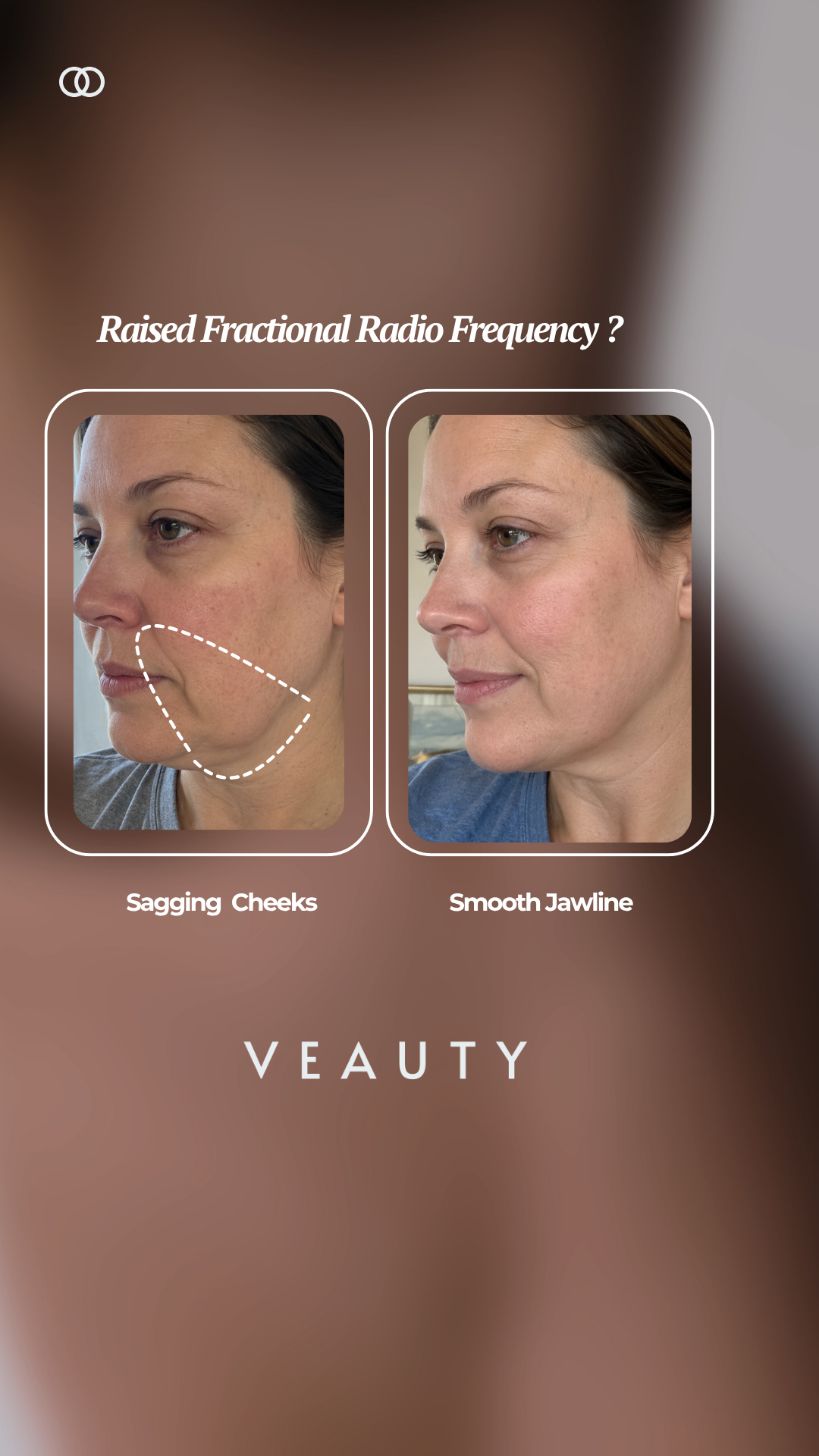 Veauty Facebook ad