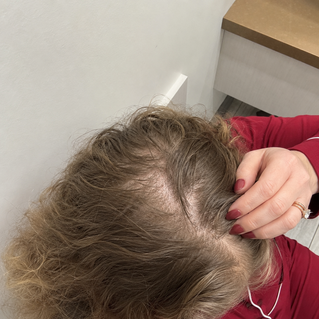 Shots & Shedding Insiders Facebook ad: Read if your hair is falling out