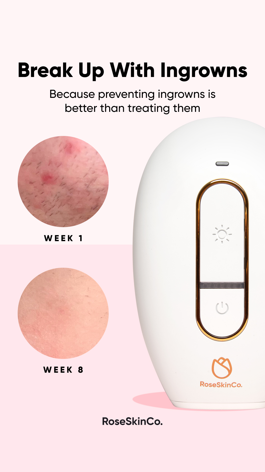 Rose Skin Co Facebook ad