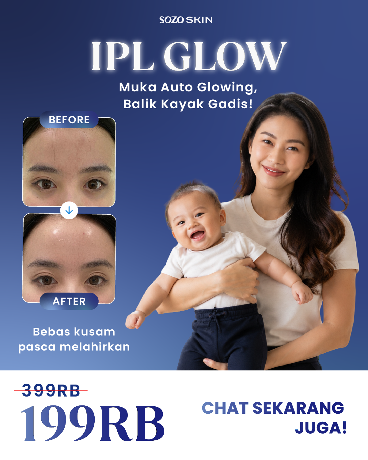 Sozo Skin Clinic Facebook ad