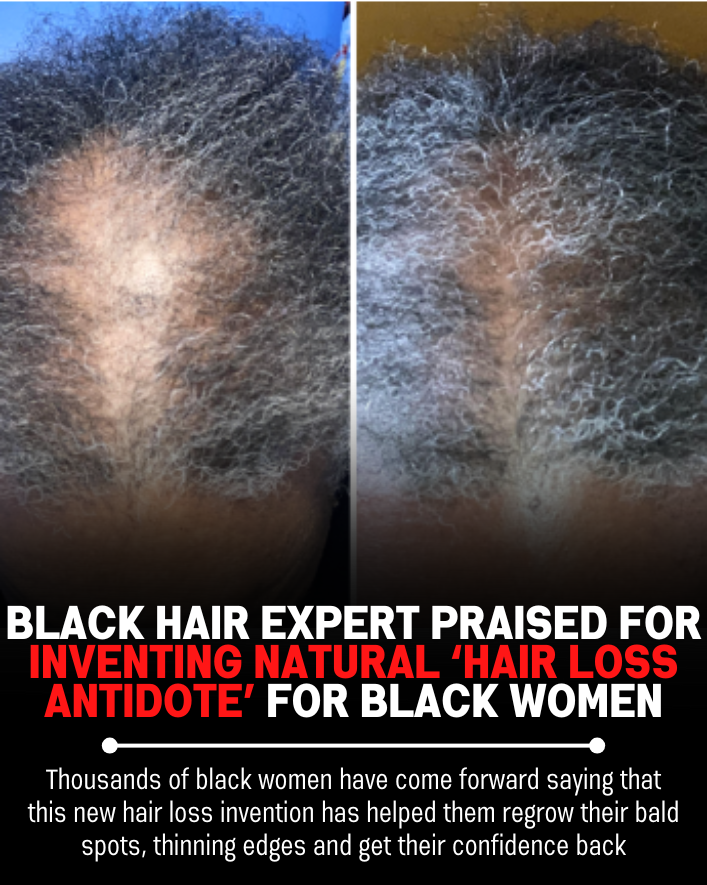Black Hair Growth Remedy Facebook ad