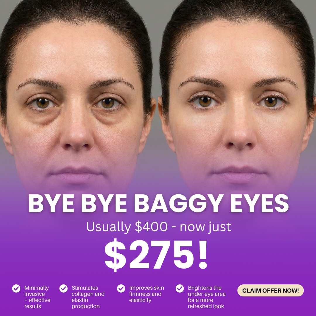 Elite Spa Massachusetts Facebook ad: Bye Bye Baggy Eyes for Only $275!