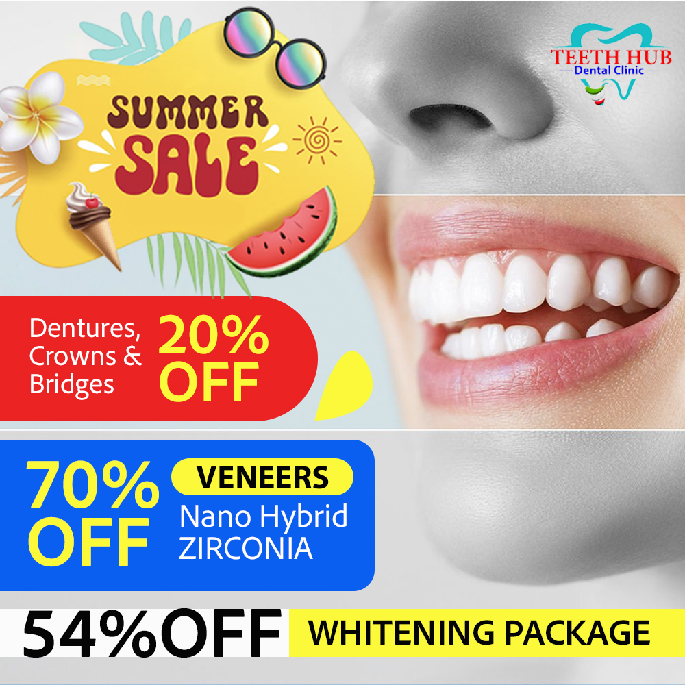 Teeth Hub Facebook ad: SUMMER SMILE PROMO at Teeth Hub Dental Clinic