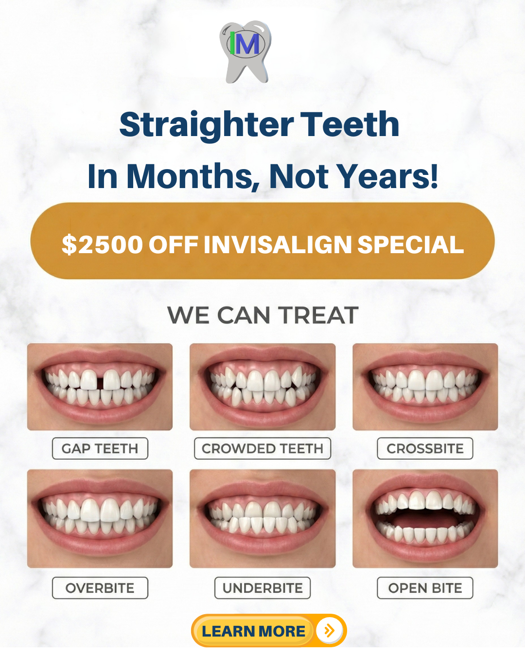 Isaac Menasha DDS Facebook ad: Hey, New Jersey! $2500 OFF Invisalign New Year special is…