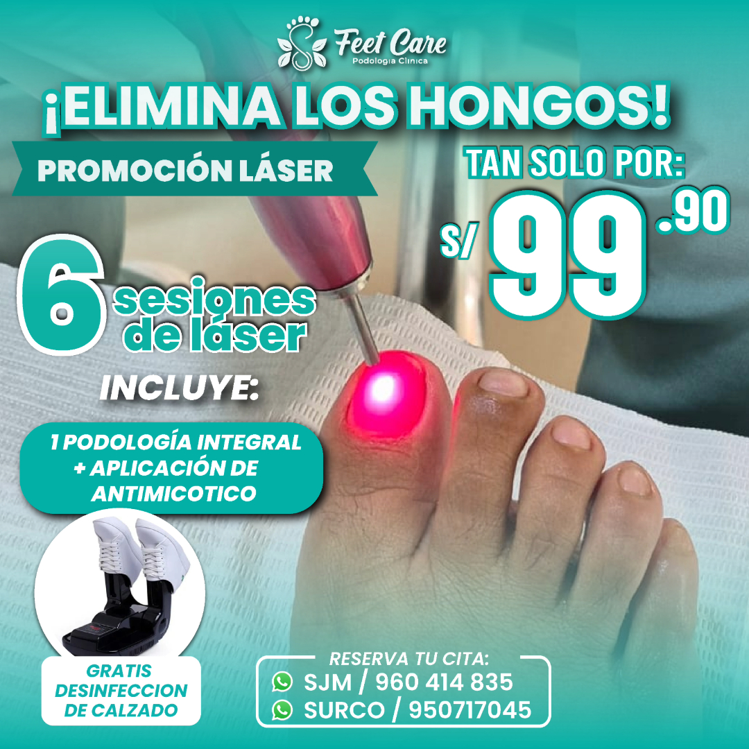 Feet Care Podología - Surco Facebook ad from Apr 26, 2026