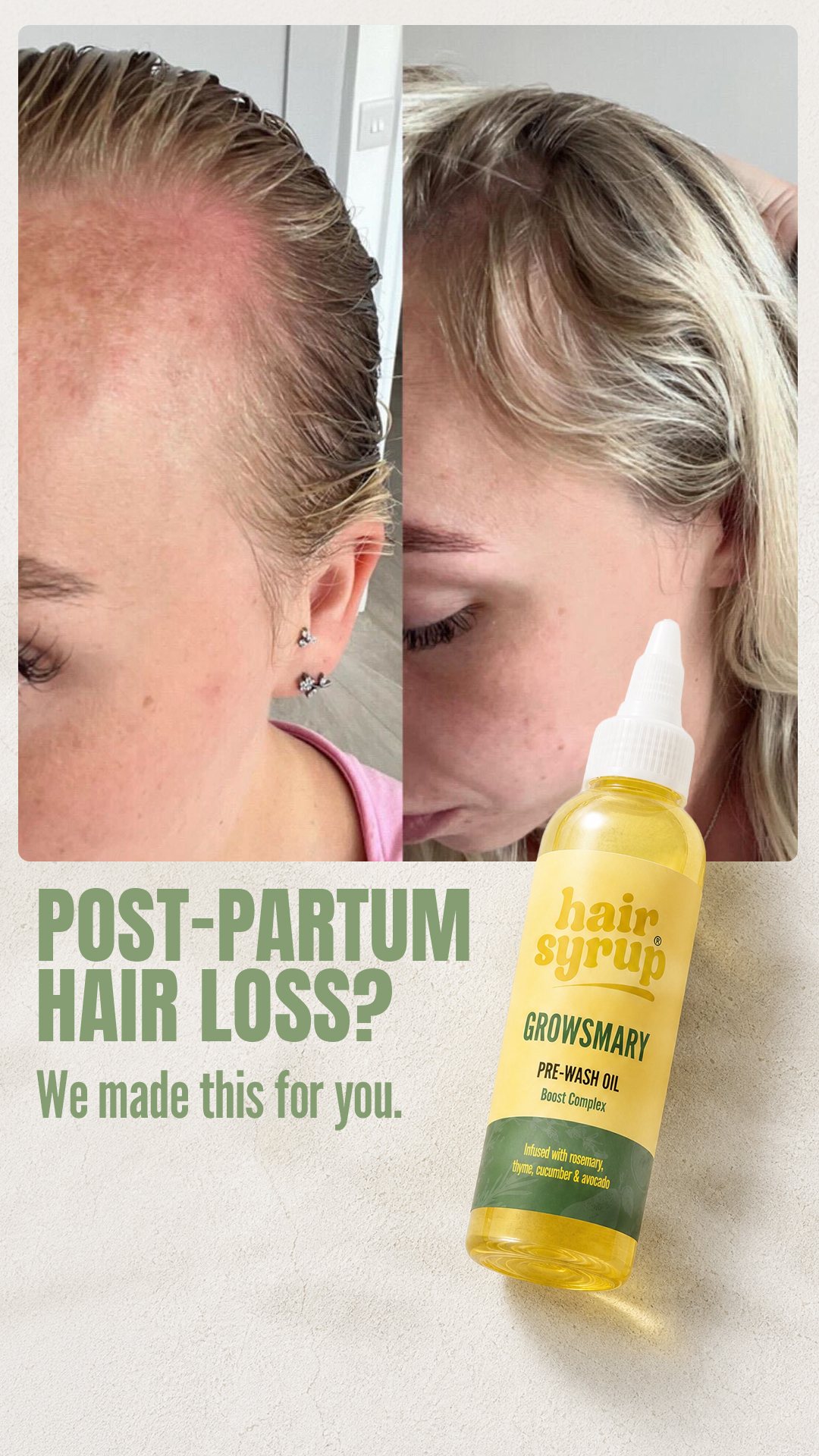 Hair Syrup Facebook ad