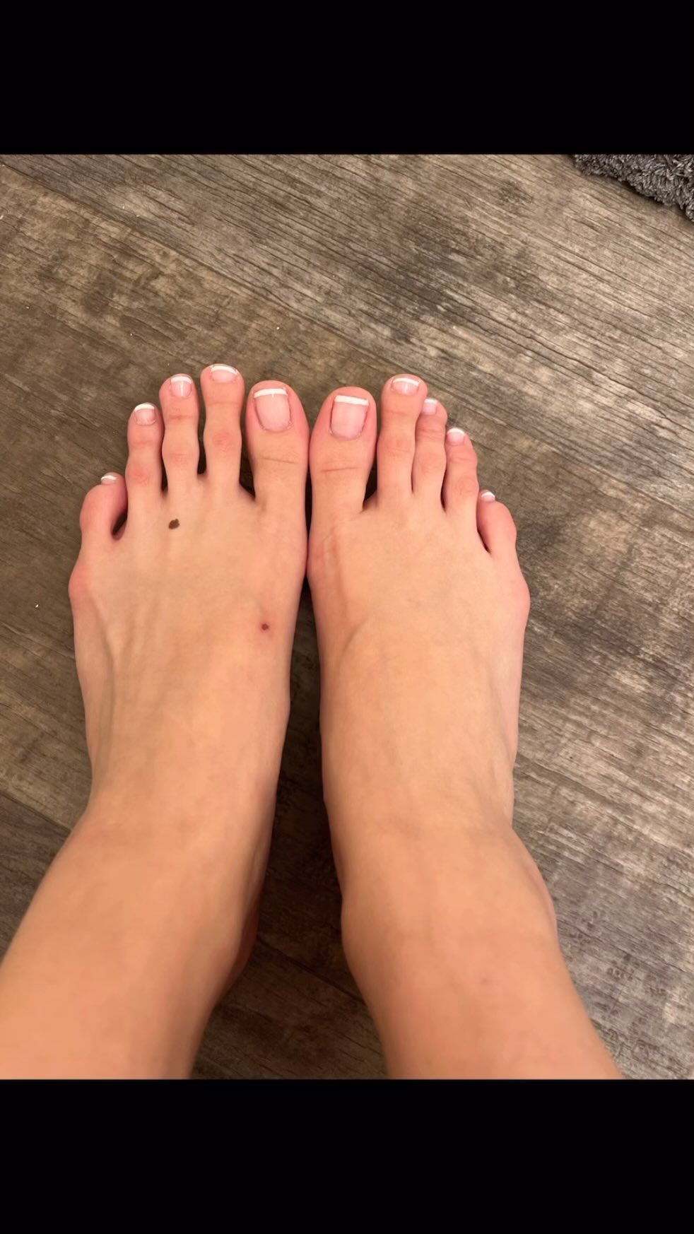 Foot First Podiatry Centers Facebook ad: Some people love long toes, some people have…