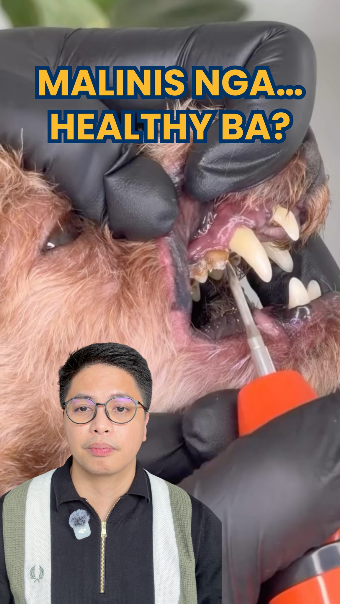 Doc Zander Facebook ad: Satisfying panoorin kapag natatanggal ang tartar sa ngipin…