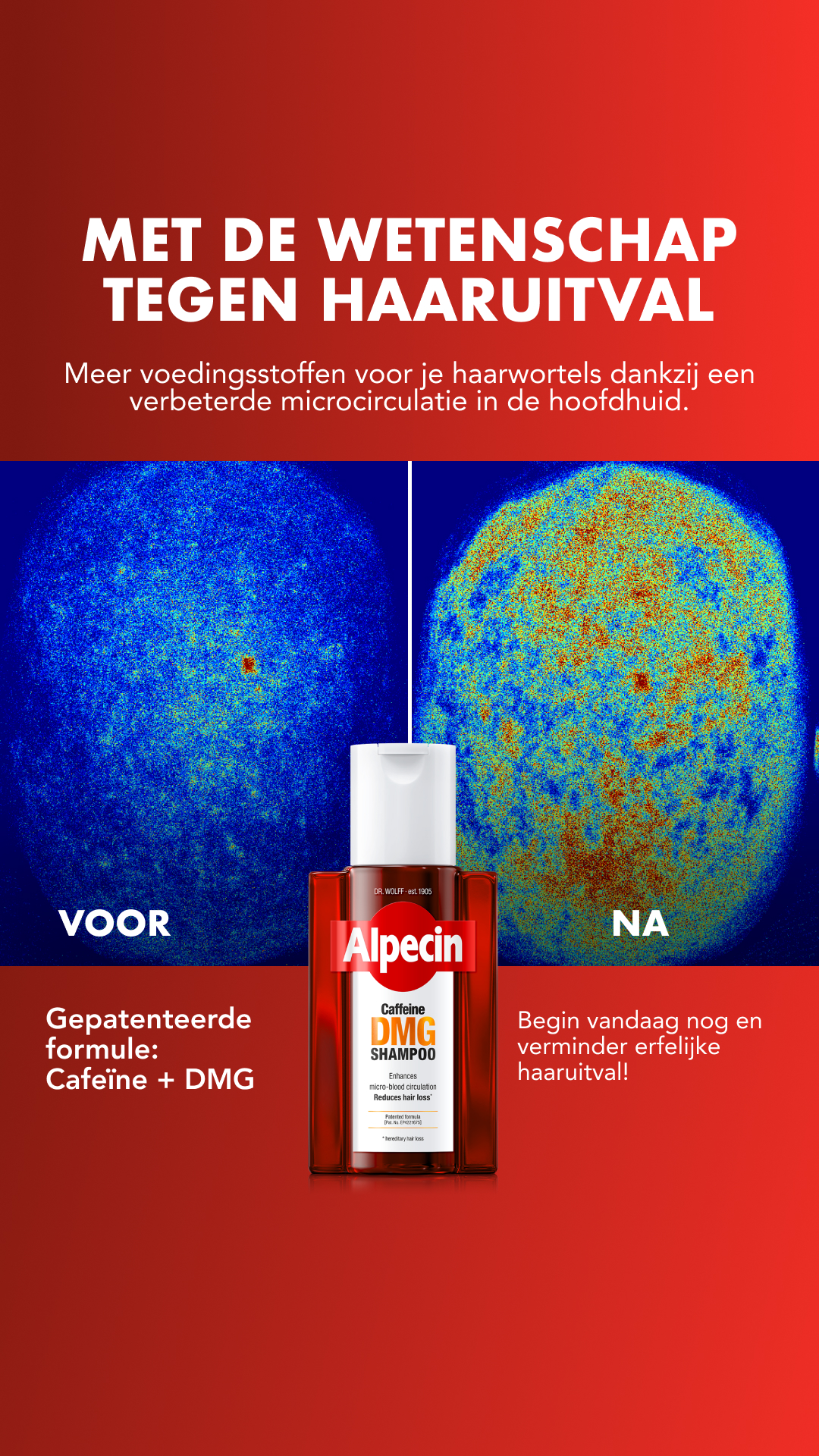 Alpecin Facebook ad
