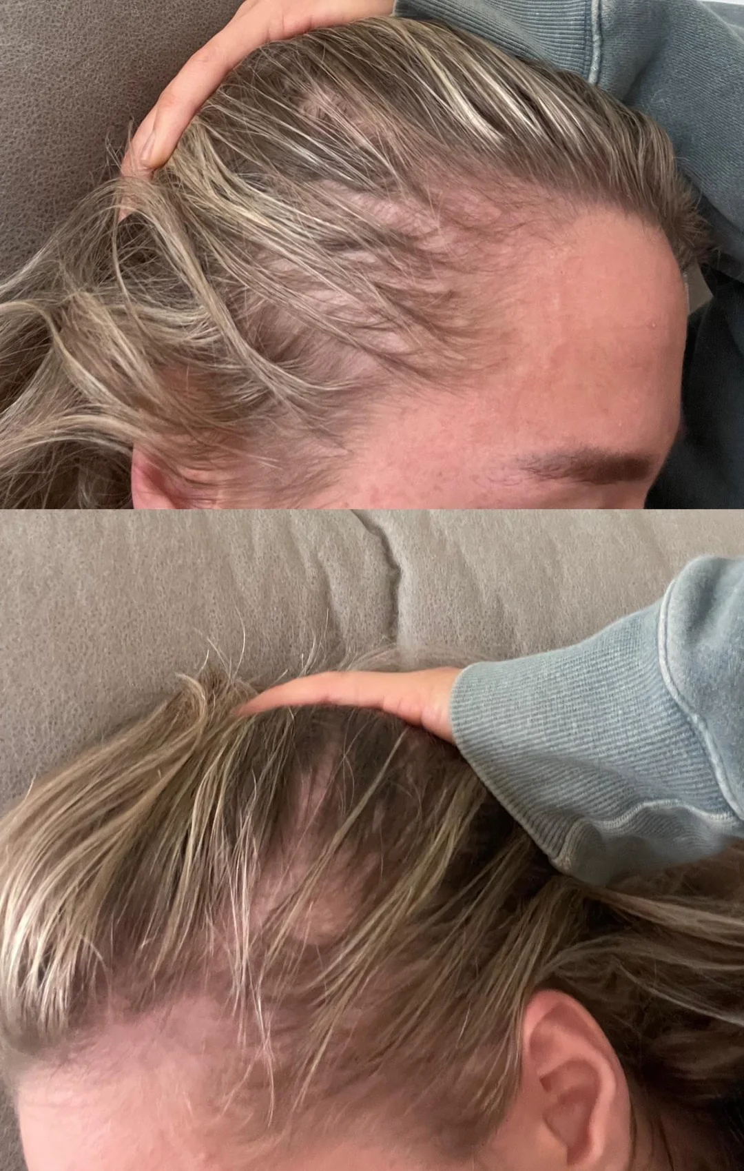 Hair Solutions Facebook ad
