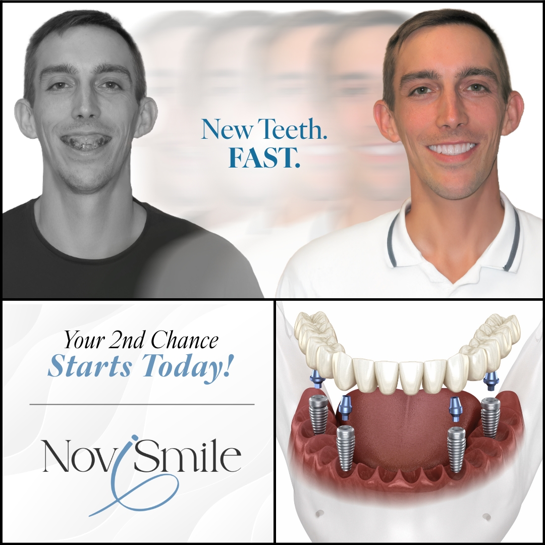 Novi Smile Facebook ad: Start your transformation now.